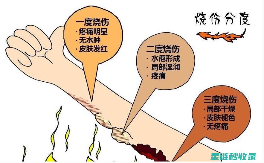 轻微烫伤急救：快速有效的处理方式 (轻微烫伤急救箱的正确使用方法)